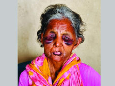 (ভিডিও)দুর্বৃত্তের হামলায় নিভে গেল সেই বাকপ্রতিবন্ধী পরিচ্ছন্নতা কর্মী ববির জীবন