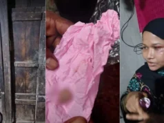 (ভিডিও)গভীর রাতে চুরির চেষ্টা, গৃহবধূর কামড়ে চোরের আঙুল বিচ্ছিন্ন